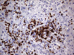 CD3 Antibody in Immunohistochemistry (Paraffin) (IHC (P))
