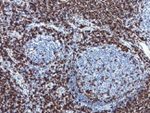 CD3 Antibody in Immunohistochemistry (Paraffin) (IHC (P))