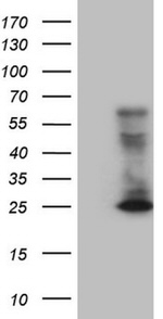 CD3 Antibody in Western Blot (WB)