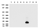 CD3 Antibody in Western Blot (WB)