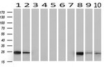 CD3 Antibody in Western Blot (WB)