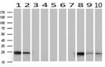 CD3 Antibody in Western Blot (WB)