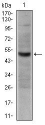 CD30 Antibody in Western Blot (WB)