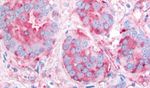 VEGF Receptor 2 Antibody in Immunohistochemistry (Paraffin) (IHC (P))