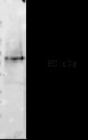 E-cadherin Antibody in Western Blot (WB)