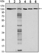 E-cadherin Monoclonal Antibody (7A2)