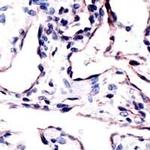 CD34 Antibody in Immunohistochemistry (IHC)
