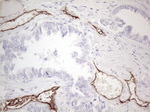 CD34 Antibody in Immunohistochemistry (Paraffin) (IHC (P))
