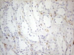 CD34 Antibody in Immunohistochemistry (Paraffin) (IHC (P))