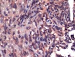 CD34 Antibody in Immunohistochemistry (IHC)