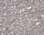 CD36 Antibody in Immunohistochemistry (Paraffin) (IHC (P))