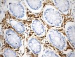 CD38 Antibody in Immunohistochemistry (Paraffin) (IHC (P))