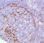 CD38 Antibody in Immunohistochemistry (IHC)