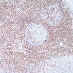 CD3e Antibody in Immunohistochemistry (IHC)