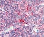 CD4 Antibody in Immunohistochemistry (IHC)