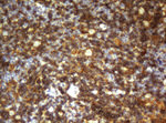 CD4 Antibody in Immunohistochemistry (Paraffin) (IHC (P))