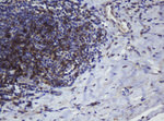 CD4 Antibody in Immunohistochemistry (Paraffin) (IHC (P))