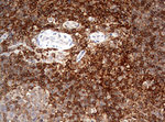 CD4 Antibody in Immunohistochemistry (Paraffin) (IHC (P))