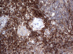 CD4 Antibody in Immunohistochemistry (Paraffin) (IHC (P))