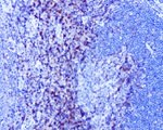 CD4 Antibody in Immunohistochemistry (Paraffin) (IHC (P))