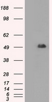 CD4 Antibody in Western Blot (WB)