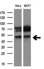 CD4 Antibody in Western Blot (WB)