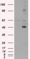 CD4 Antibody in Western Blot (WB)