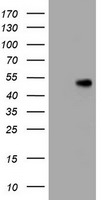 CD4 Antibody in Western Blot (WB)