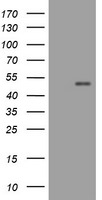 CD4 Antibody in Western Blot (WB)