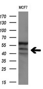 CD4 Antibody in Western Blot (WB)