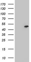 CD4 Antibody in Western Blot (WB)