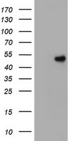 CD4 Antibody in Western Blot (WB)