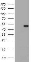 CD4 Antibody in Western Blot (WB)
