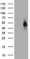 CD4 Antibody in Western Blot (WB)