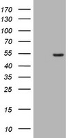 CD4 Antibody in Western Blot (WB)