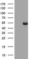 CD4 Antibody in Western Blot (WB)