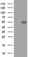 CD4 Antibody in Western Blot (WB)