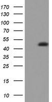 CD4 Antibody in Western Blot (WB)
