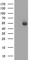 CD4 Antibody in Western Blot (WB)