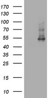 CD4 Antibody in Western Blot (WB)