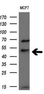 CD4 Antibody in Western Blot (WB)