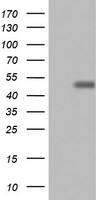 CD4 Antibody in Western Blot (WB)