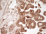 CD40 Antibody in Immunohistochemistry (Paraffin) (IHC (P))