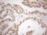 CD40 Antibody in Immunohistochemistry (Paraffin) (IHC (P))