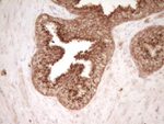 CD40 Antibody in Immunohistochemistry (Paraffin) (IHC (P))
