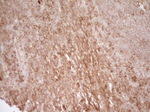 CD40 Antibody in Immunohistochemistry (Paraffin) (IHC (P))