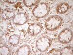 CD40 Antibody in Immunohistochemistry (Paraffin) (IHC (P))
