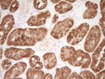 CD40 Antibody in Immunohistochemistry (Paraffin) (IHC (P))