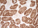 CD40 Antibody in Immunohistochemistry (Paraffin) (IHC (P))