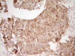 CD40 Antibody in Immunohistochemistry (Paraffin) (IHC (P))